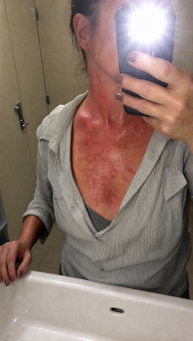“I stopped planning around hot flashes”